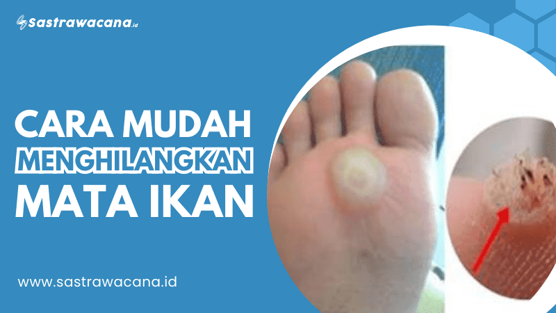 cara menghilangkan mata ikan
