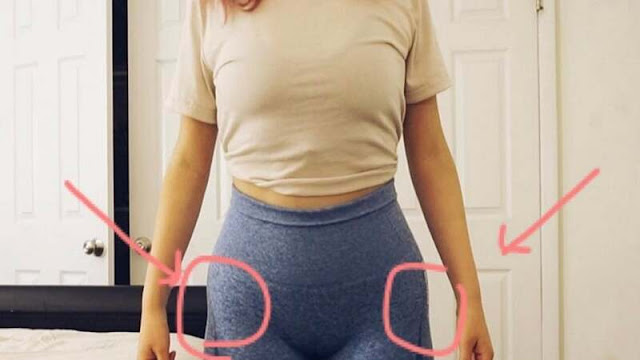 hip dips